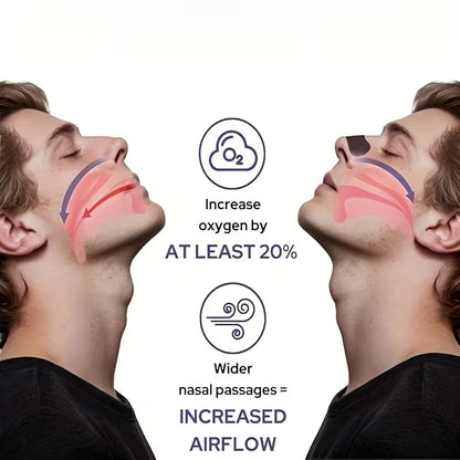 Nasal Strips 30pk